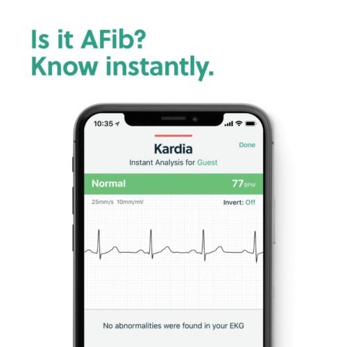 Alivecor® KardiaMobile EKG Monitor | FDA-Cleared | Wireless Personal EKG | Detects Afib in 30 Seconds 4
