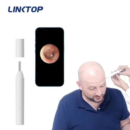 Digital Otoscope Your home Doctor For Ear Examination And Protection 7